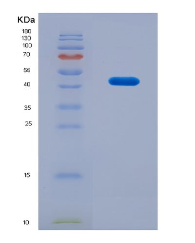 SDS-PAGE analysis of Human Tyrosine Phosphatase Receptor Type N (PTPRN) - Recombinant Protein, CAT# BLT-08885P showing >90% purity under 15% SDS-PAGE (Reduced)Human Tyrosine Phosphatase Receptor Type N (PTPRN) - Recombinant Protein
