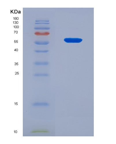 SDS-PAGE analysis of Human IL4I1 (L-Amino-Acid Oxidase) - Recombinant Protein, CATHuman IL4I1 (L-Amino-Acid Oxidase) - Recombinant Protein