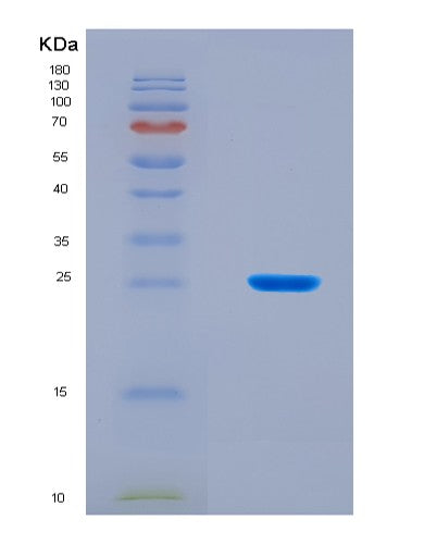 SDS-PAGE analysis of Human SLC2A9 (Solute Carrier Family 2, Facilitated Glucose Transporter Member 9) - Recombinant Protein, CATHuman SLC2A9 (Solute Carrier Family 2, Facilitated Glucose Transporter Member 9) - Recombinant Protein