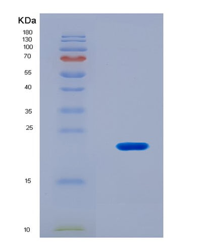 SDS-PAGE analysis of Mouse Tp53bp1 (Tp53-Binding Protein 1) - Recombinant Protein, CAT# BLT-08888P showing >90% purity under 15% SDS-PAGE (Reduced)Mouse Tp53bp1 (Tp53-Binding Protein 1) - Recombinant Protein