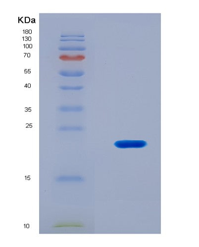 SDS-PAGE analysis of Mouse Tp53bp1 (Tp53-Binding Protein 1) - Recombinant Protein, CATMouse Tp53bp1 (Tp53-Binding Protein 1) - Recombinant Protein