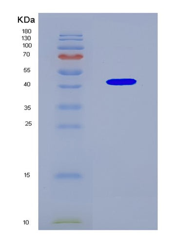 SDS-PAGE analysis of Mouse Nxf1 (Nuclear Rna Export Factor 1) - Recombinant Protein, CAT# BLT-08889P showing >90% purity under 15% SDS-PAGE (Reduced)Mouse Nxf1 (Nuclear Rna Export Factor 1) - Recombinant Protein
