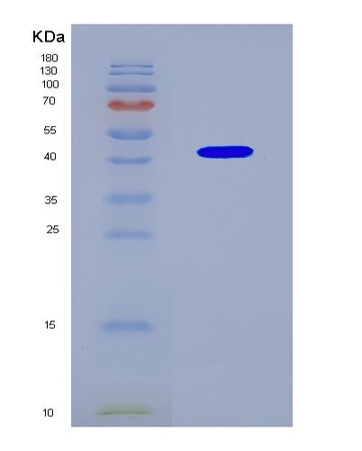 SDS-PAGE analysis of Mouse Nxf1 (Nuclear Rna Export Factor 1) - Recombinant Protein, CATMouse Nxf1 (Nuclear Rna Export Factor 1) - Recombinant Protein