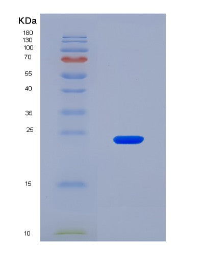 SDS-PAGE analysis of Human WDR11 (Wd Repeat-Containing Protein 11) - Recombinant Protein, CATHuman WDR11 (Wd Repeat-Containing Protein 11) - Recombinant Protein