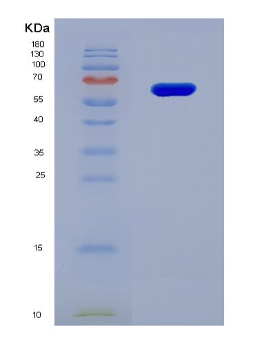 SDS-PAGE analysis of Human P4HA1 (Prolyl 4-Hydroxylase Subunit Alpha-1) - Recombinant Protein, CATHuman P4HA1 (Prolyl 4-Hydroxylase Subunit Alpha-1) - Recombinant Protein