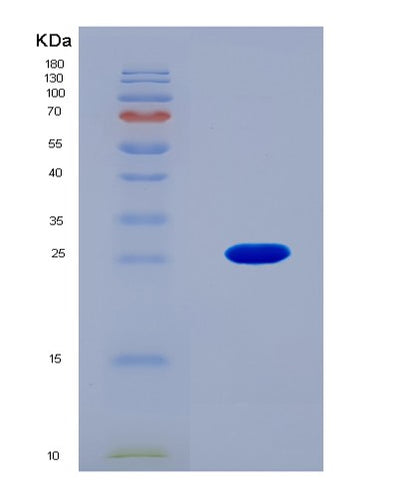 SDS-PAGE analysis of Human GC (Vitamin D-Binding Protein) - Recombinant Protein, CAT# BLT-08895P showing >90% purity under 15% SDS-PAGE (Reduced)Human GC (Vitamin D-Binding Protein) - Recombinant Protein