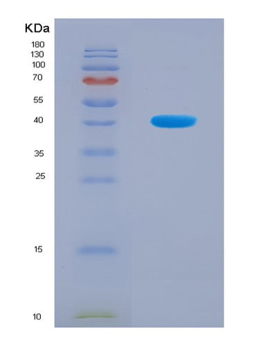 SDS-PAGE analysis of Human HEPH (Hephaestin) - Recombinant Protein, CAT# BLT-08899P showing >90% purity under 15% SDS-PAGE (Reduced)Human HEPH (Hephaestin) - Recombinant Protein