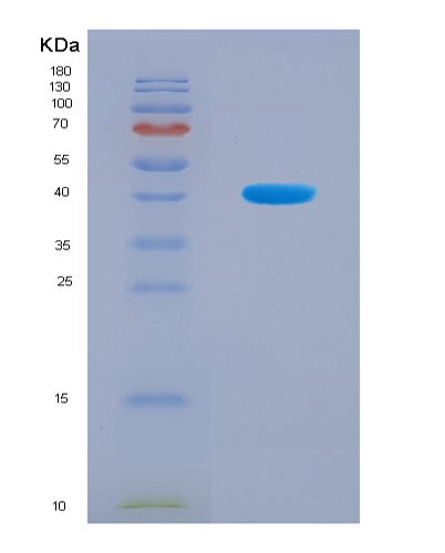 SDS-PAGE analysis of Human HEPH (Hephaestin) - Recombinant Protein, CATHuman HEPH (Hephaestin) - Recombinant Protein