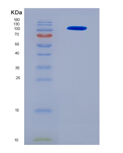 SDS-PAGE analysis of Human RECK (Reversion-Inducing Cysteine-Rich Protein With Kazal Motifs) - Recombinant Protein, CATHuman RECK (Reversion-Inducing Cysteine-Rich Protein With Kazal Motifs) - Recombinant Protein