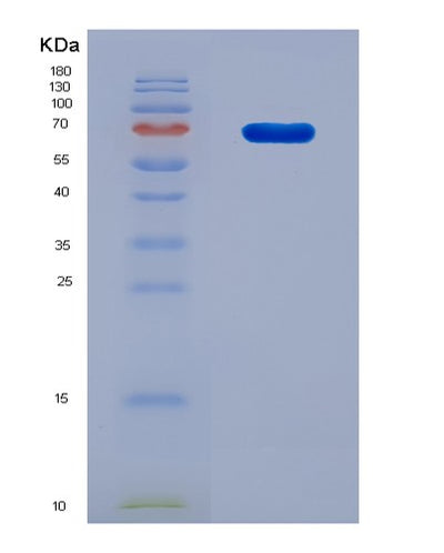 SDS-PAGE analysis of Human F2 (Prothrombin) - Recombinant Protein, CAT# BLT-08902P showing >90% purity under 15% SDS-PAGE (Reduced)Human F2 (Prothrombin) - Recombinant Protein
