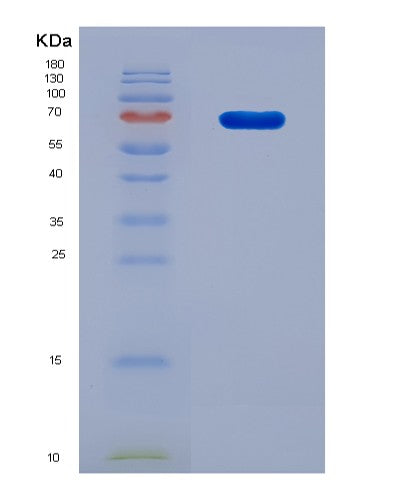 SDS-PAGE analysis of Human F2 (Prothrombin) - Recombinant Protein, CATHuman F2 (Prothrombin) - Recombinant Protein