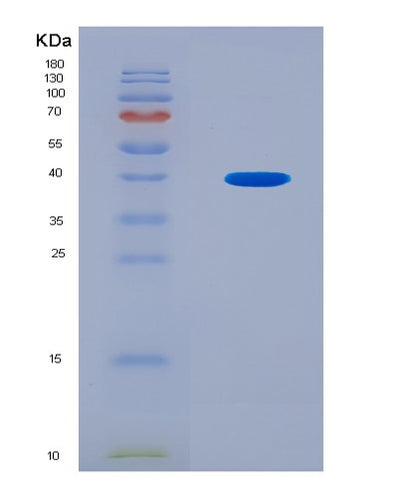 SDS-PAGE analysis of Mouse Nt5c3a (Cytosolic 5'-Nucleotidase 3A) - Recombinant Protein, CAT# BLT-08903P showing >90% purity under 15% SDS-PAGE (Reduced)Mouse Nt5c3a (Cytosolic 5'-Nucleotidase 3A) - Recombinant Protein