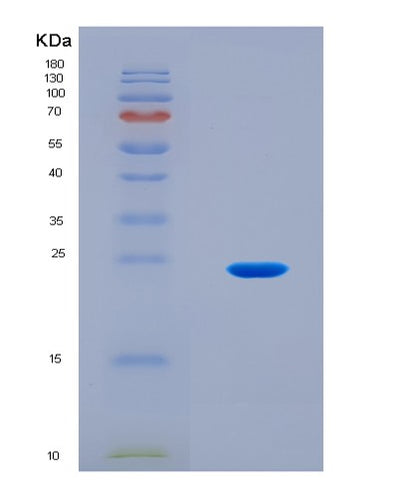 SDS-PAGE analysis of Human SIN3A (Paired Amphipathic Helix Protein Sin3A) - Recombinant Protein, CAT# BLT-08907P showing >90% purity under 15% SDS-PAGE (Reduced)Human SIN3A (Paired Amphipathic Helix Protein Sin3A) - Recombinant Protein