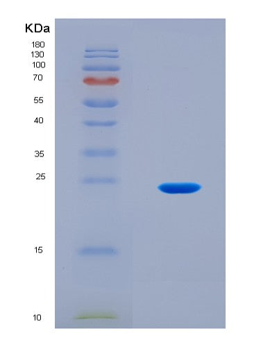SDS-PAGE analysis of Human SIN3A (Paired Amphipathic Helix Protein Sin3A) - Recombinant Protein, CATHuman SIN3A (Paired Amphipathic Helix Protein Sin3A) - Recombinant Protein