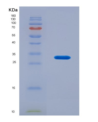 SDS-PAGE analysis of Human NR1H2 (Oxysterols Receptor Lxr-Beta) - Recombinant Protein, CATHuman NR1H2 (Oxysterols Receptor Lxr-Beta) - Recombinant Protein