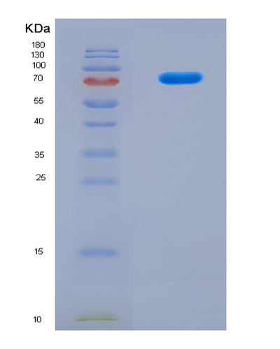 SDS-PAGE analysis of Human NSUN2 (Rna Cytosine C(5)-Methyltransferase Nsun2) - Recombinant Protein, CAT# BLT-08911P showing >90% purity under 15% SDS-PAGE (Reduced)Human NSUN2 (Rna Cytosine C(5)-Methyltransferase Nsun2) - Recombinant Protein