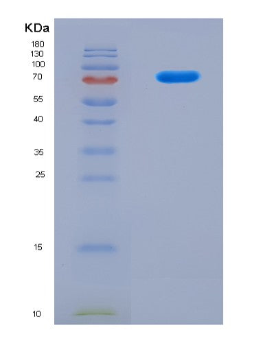 SDS-PAGE analysis of Human NSUN2 (Rna Cytosine C(5)-Methyltransferase Nsun2) - Recombinant Protein, CATHuman NSUN2 (Rna Cytosine C(5)-Methyltransferase Nsun2) - Recombinant Protein