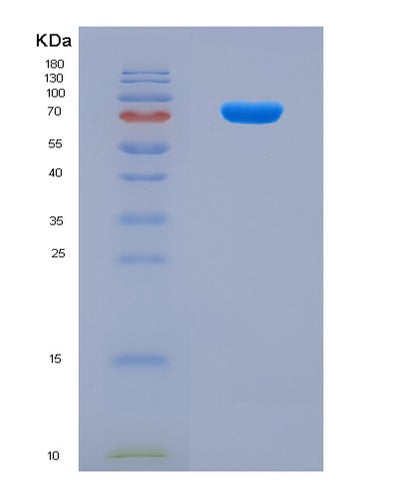 SDS-PAGE analysis of Human NSUN2 (Rna Cytosine C(5)-Methyltransferase Nsun2) - Recombinant Protein, CAT# BLT-08912P showing >90% purity under 15% SDS-PAGE (Reduced)Human NSUN2 (Rna Cytosine C(5)-Methyltransferase Nsun2) - Recombinant Protein