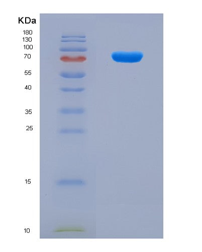 SDS-PAGE analysis of Human NSUN2 (Rna Cytosine C(5)-Methyltransferase Nsun2) - Recombinant Protein, CATHuman NSUN2 (Rna Cytosine C(5)-Methyltransferase Nsun2) - Recombinant Protein