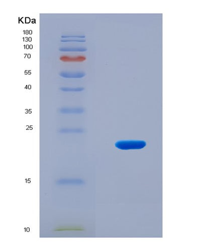 SDS-PAGE analysis of Human EPAS1 (Endothelial Pas Domain-Containing Protein 1) - Recombinant Protein, CAT# BLT-08913P showing >90% purity under 15% SDS-PAGE (Reduced)Human EPAS1 (Endothelial Pas Domain-Containing Protein 1) - Recombinant Protein