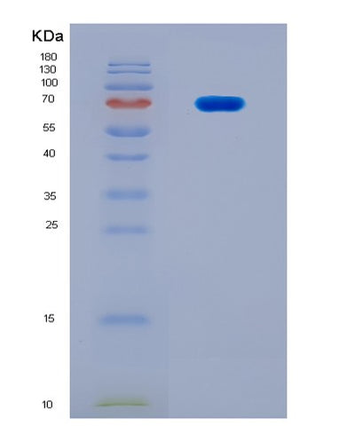 SDS-PAGE analysis of Human NFIC (Nuclear Factor 1 C-Type) - Recombinant Protein, CAT# BLT-08918P showing >90% purity under 15% SDS-PAGE (Reduced)Human NFIC (Nuclear Factor 1 C-Type) - Recombinant Protein