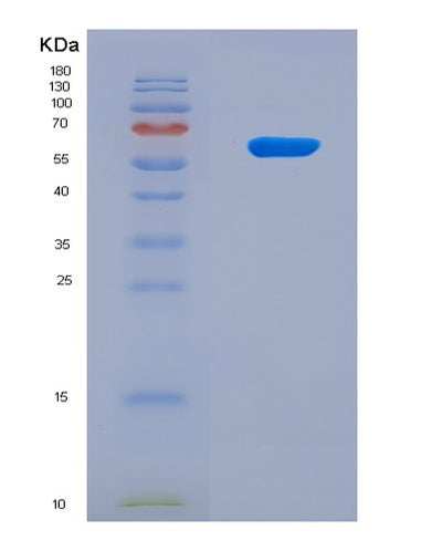 SDS-PAGE analysis of Mouse Cgas (Cyclic Gmp-Amp Synthase) - Recombinant Protein, CAT# BLT-08919P showing >90% purity under 15% SDS-PAGE (Reduced)Mouse Cgas (Cyclic Gmp-Amp Synthase) - Recombinant Protein