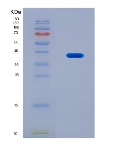 SDS-PAGE analysis of Human CTCFL (Transcriptional Repressor Ctcfl) - Recombinant Protein, CAT# BLT-08922P showing >90% purity under 15% SDS-PAGE (Reduced)Human CTCFL (Transcriptional Repressor Ctcfl) - Recombinant Protein