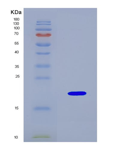 SDS-PAGE analysis of Mouse Reg4 (Regenerating Islet-Derived Protein 4) - Recombinant Protein, CAT# BLT-08923P showing >90% purity under 15% SDS-PAGE (Reduced)Mouse Reg4 (Regenerating Islet-Derived Protein 4) - Recombinant Protein
