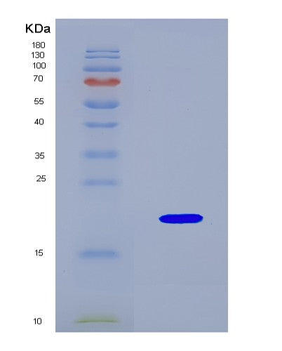 SDS-PAGE analysis of Mouse Reg4 (Regenerating Islet-Derived Protein 4) - Recombinant Protein, CATMouse Reg4 (Regenerating Islet-Derived Protein 4) - Recombinant Protein
