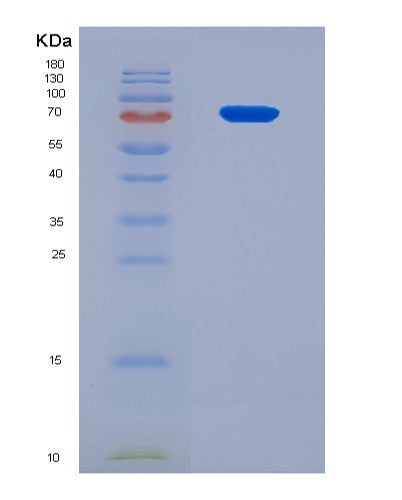 SDS-PAGE analysis of Human KRT7 (Keratin, Type Ii Cytoskeletal 7) - Recombinant Protein, CATHuman KRT7 (Keratin, Type Ii Cytoskeletal 7) - Recombinant Protein