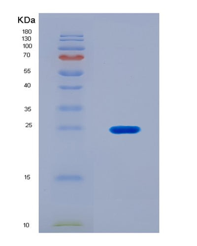 SDS-PAGE analysis of Human CDC42 (Cell Division Control Protein 42 Homolog) - Recombinant Protein, CAT# BLT-08928P showing >90% purity under 15% SDS-PAGE (Reduced)Human CDC42 (Cell Division Control Protein 42 Homolog) - Recombinant Protein