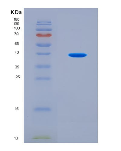 SDS-PAGE analysis of Mouse Rab27a (Ras-Related Protein Rab-27A) - Recombinant Protein, CAT# BLT-08929P showing >90% purity under 15% SDS-PAGE (Reduced)Mouse Rab27a (Ras-Related Protein Rab-27A) - Recombinant Protein