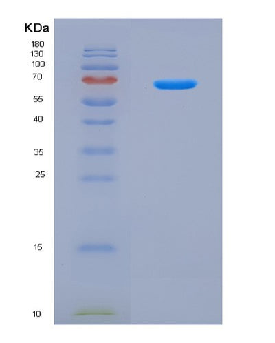 SDS-PAGE analysis of Mouse Vps4a (Vacuolar Protein Sorting-Associated Protein 4A) - Recombinant Protein, CAT# BLT-08930P showing >90% purity under 15% SDS-PAGE (Reduced)Mouse Vps4a (Vacuolar Protein Sorting-Associated Protein 4A) - Recombinant Protein