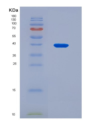 SDS-PAGE analysis of Mouse Rab5a (Ras-Related Protein Rab-5A) - Recombinant Protein, CATMouse Rab5a (Ras-Related Protein Rab-5A) - Recombinant Protein