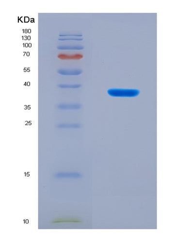 SDS-PAGE analysis of Mouse Rab7a (Ras-Related Protein Rab-7A) - Recombinant Protein, CAT# BLT-08932P showing >90% purity under 15% SDS-PAGE (Reduced)Mouse Rab7a (Ras-Related Protein Rab-7A) - Recombinant Protein
