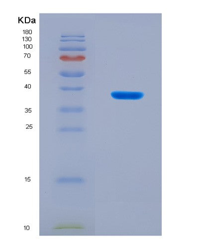 SDS-PAGE analysis of Mouse Rab7a (Ras-Related Protein Rab-7A) - Recombinant Protein, CATMouse Rab7a (Ras-Related Protein Rab-7A) - Recombinant Protein