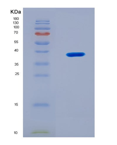 SDS-PAGE analysis of Mouse Rab35 (Ras-Related Protein Rab-35) - Recombinant Protein, CAT# BLT-08933P showing >90% purity under 15% SDS-PAGE (Reduced)Mouse Rab35 (Ras-Related Protein Rab-35) - Recombinant Protein