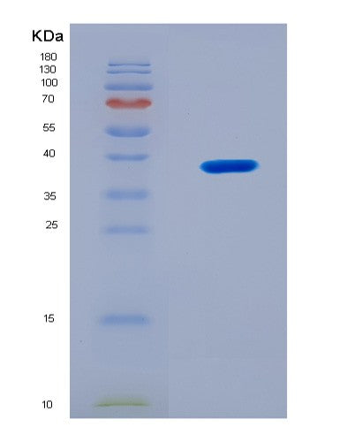 SDS-PAGE analysis of Mouse Rab35 (Ras-Related Protein Rab-35) - Recombinant Protein, CATMouse Rab35 (Ras-Related Protein Rab-35) - Recombinant Protein