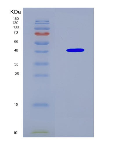 SDS-PAGE analysis of Mouse Rab27b (Ras-Related Protein Rab-27B) - Recombinant Protein, CAT# BLT-08934P showing >90% purity under 15% SDS-PAGE (Reduced)Mouse Rab27b (Ras-Related Protein Rab-27B) - Recombinant Protein