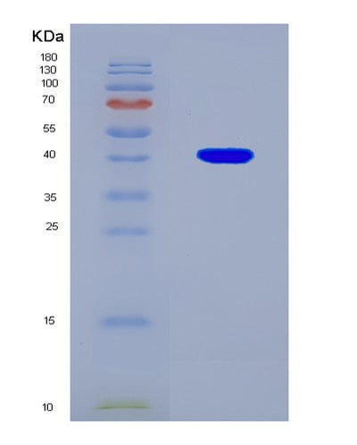 SDS-PAGE analysis of Human RAF1 (Raf Proto-Oncogene Serine/Threonine-Protein Kinase) - Recombinant Protein, CAT# BLT-08935P showing >90% purity under 15% SDS-PAGE (Reduced)Human RAF1 (Raf Proto-Oncogene Serine/Threonine-Protein Kinase) - Recombinant Protein