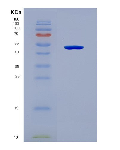 SDS-PAGE analysis of Human HEXA (Beta-Hexosaminidase Subunit Alpha) - Recombinant Protein, CATHuman HEXA (Beta-Hexosaminidase Subunit Alpha) - Recombinant Protein