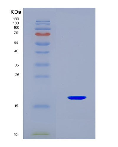 SDS-PAGE analysis of Human ANGPT2 (Angiopoietin-2) - Recombinant Protein, CAT# BLT-08937P showing >90% purity under 15% SDS-PAGE (Reduced)Human ANGPT2 (Angiopoietin-2) - Recombinant Protein