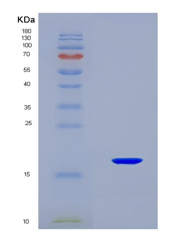 SDS-PAGE analysis of Human ANGPT2 (Angiopoietin-2) - Recombinant Protein, CATHuman ANGPT2 (Angiopoietin-2) - Recombinant Protein