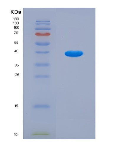 SDS-PAGE analysis of Human MT-ND1 (Nadh-Ubiquinone Oxidoreductase Chain 1) - Recombinant Protein, CAT# BLT-08938P showing >90% purity under 15% SDS-PAGE (Reduced)Human MT-ND1 (Nadh-Ubiquinone Oxidoreductase Chain 1) - Recombinant Protein