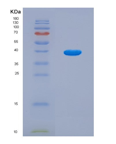 SDS-PAGE analysis of Human MT-ND1 (Nadh-Ubiquinone Oxidoreductase Chain 1) - Recombinant Protein, CATHuman MT-ND1 (Nadh-Ubiquinone Oxidoreductase Chain 1) - Recombinant Protein