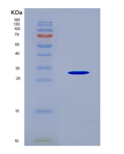 SDS-PAGE analysis of Mouse Abcc1 (Multidrug Resistance-Associated Protein 1) - Recombinant Protein, CAT# BLT-08940P showing >90% purity under 15% SDS-PAGE (Reduced)Mouse Abcc1 (Multidrug Resistance-Associated Protein 1) - Recombinant Protein