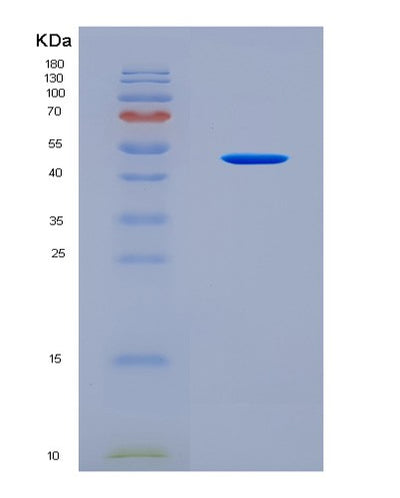 SDS-PAGE analysis of Human TFG (Protein Tfg) - Recombinant Protein, CAT# BLT-08941P showing >90% purity under 15% SDS-PAGE (Reduced)Human TFG (Protein Tfg) - Recombinant Protein