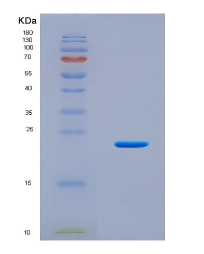 SDS-PAGE analysis of Human MB (Myoglobin) - Recombinant Protein, CAT# BLT-08942P showing >90% purity under 15% SDS-PAGE (Reduced)Human MB (Myoglobin) - Recombinant Protein