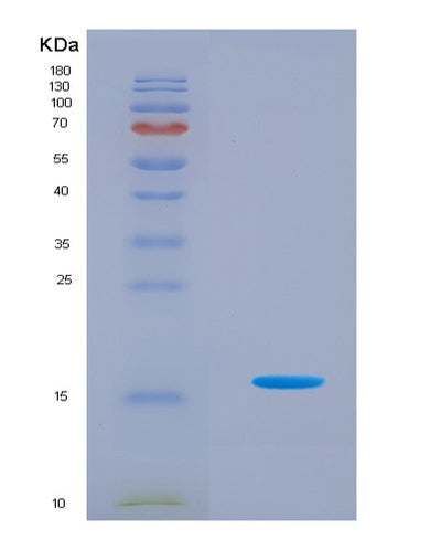 SDS-PAGE analysis of Human FABP3 (Fatty Acid-Binding Protein, Heart) - Recombinant Protein, CAT# BLT-08943P showing >90% purity under 15% SDS-PAGE (Reduced)Human FABP3 (Fatty Acid-Binding Protein, Heart) - Recombinant Protein