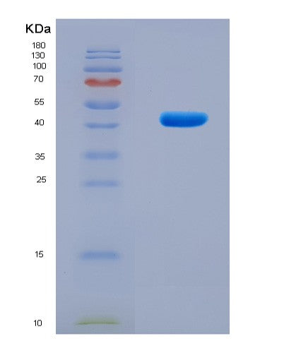 SDS-PAGE analysis of Human SNRPA (U1 Small Nuclear Ribonucleoprotein A) - Recombinant Protein, CATHuman SNRPA (U1 Small Nuclear Ribonucleoprotein A) - Recombinant Protein